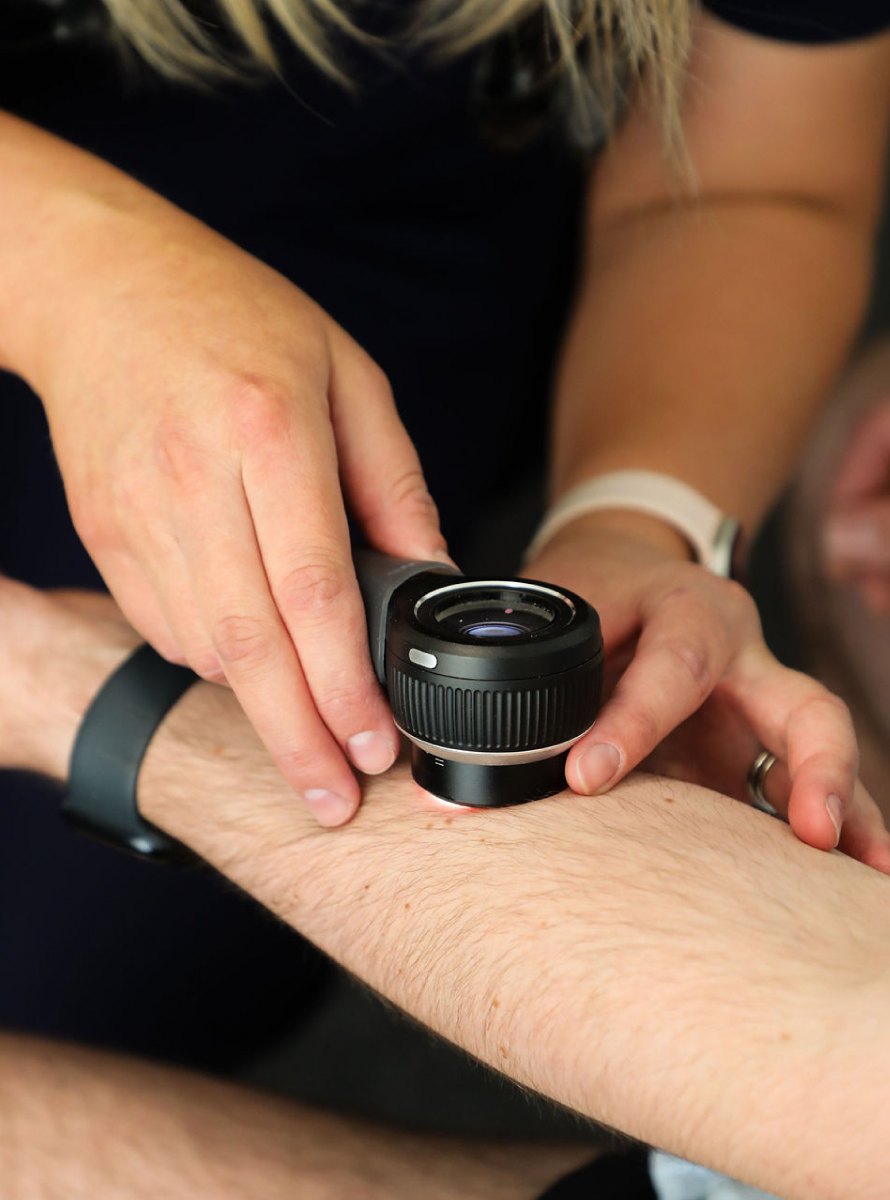 A clinician performing a skin check